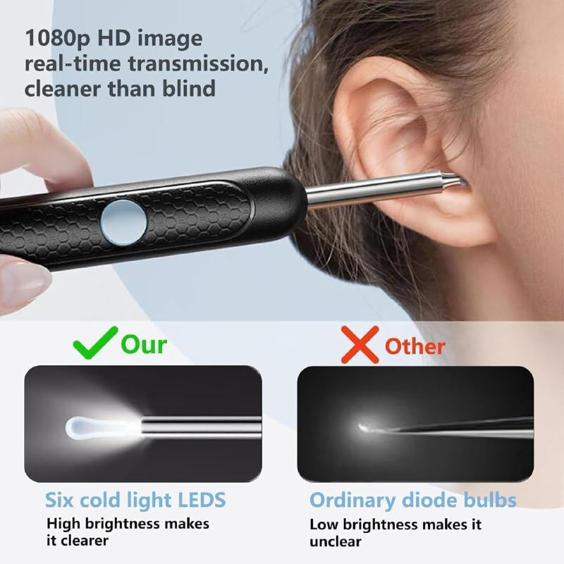 Smart Ear Cleaner Camera – Wireless HD Ear Wax Removal Kit