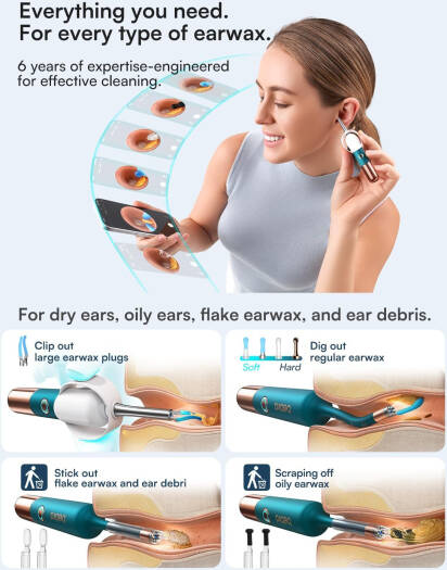 Smart Ear Cleaner Camera – Wireless HD Ear Wax Removal Kit
