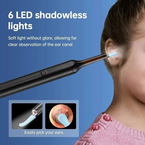 Smart Ear Cleaner Camera – Wireless HD Ear Wax Removal Kit